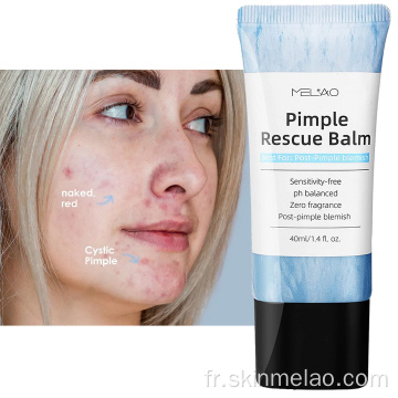 Sensibilité sur l&#39;implétude PH Balanced Acne Pimples Treat Treat Cream
